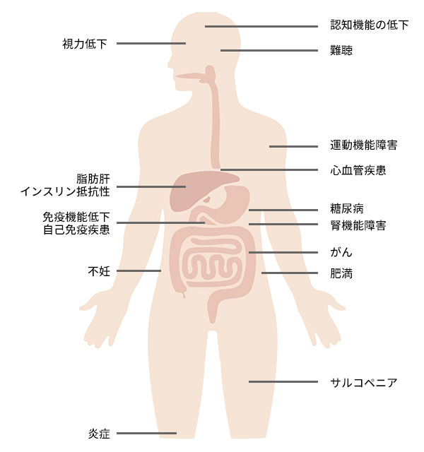 サーチュインが関与する疾患