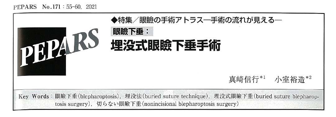 埋没式眼瞼下垂手術