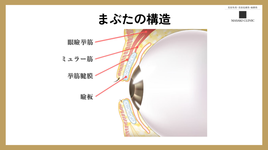 まぶたの構造を簡単に解説した画像