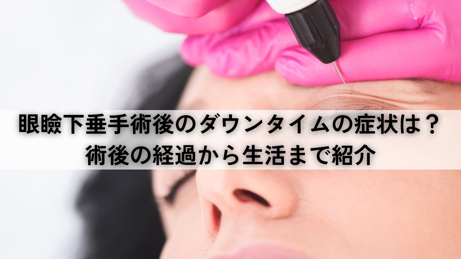 眼瞼下垂手術後のダウンタイムの症状は？術後の経過から生活まで紹介