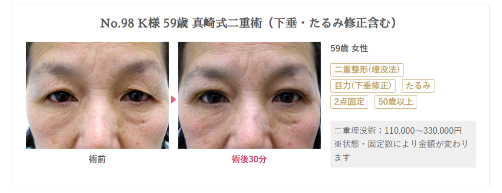 真崎医院様症例写真