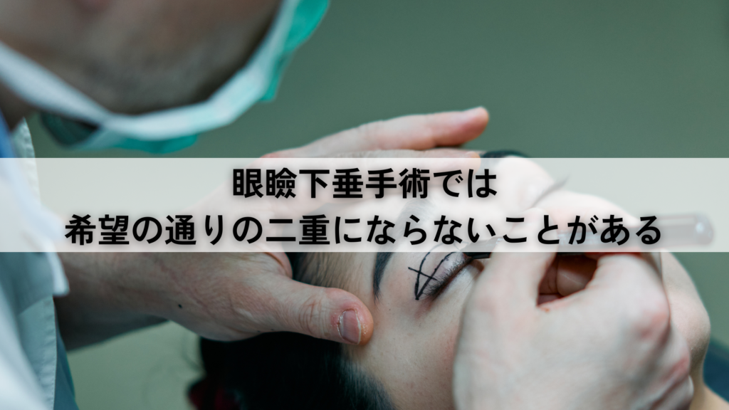 眼瞼下垂手術では希望の通りの二重にならないことがある