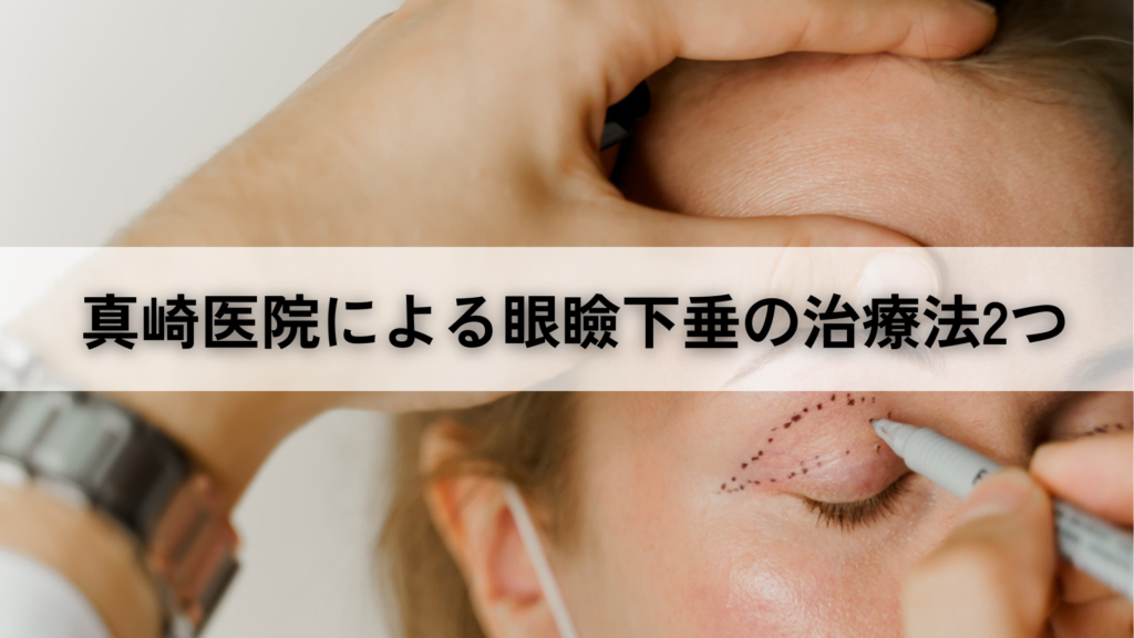 真崎医院による眼瞼下垂の治療法2つ