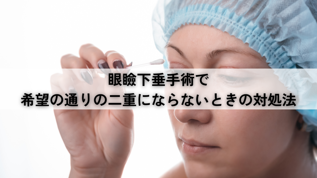 眼瞼下垂手術で希望の通りの二重にならないときの対処法