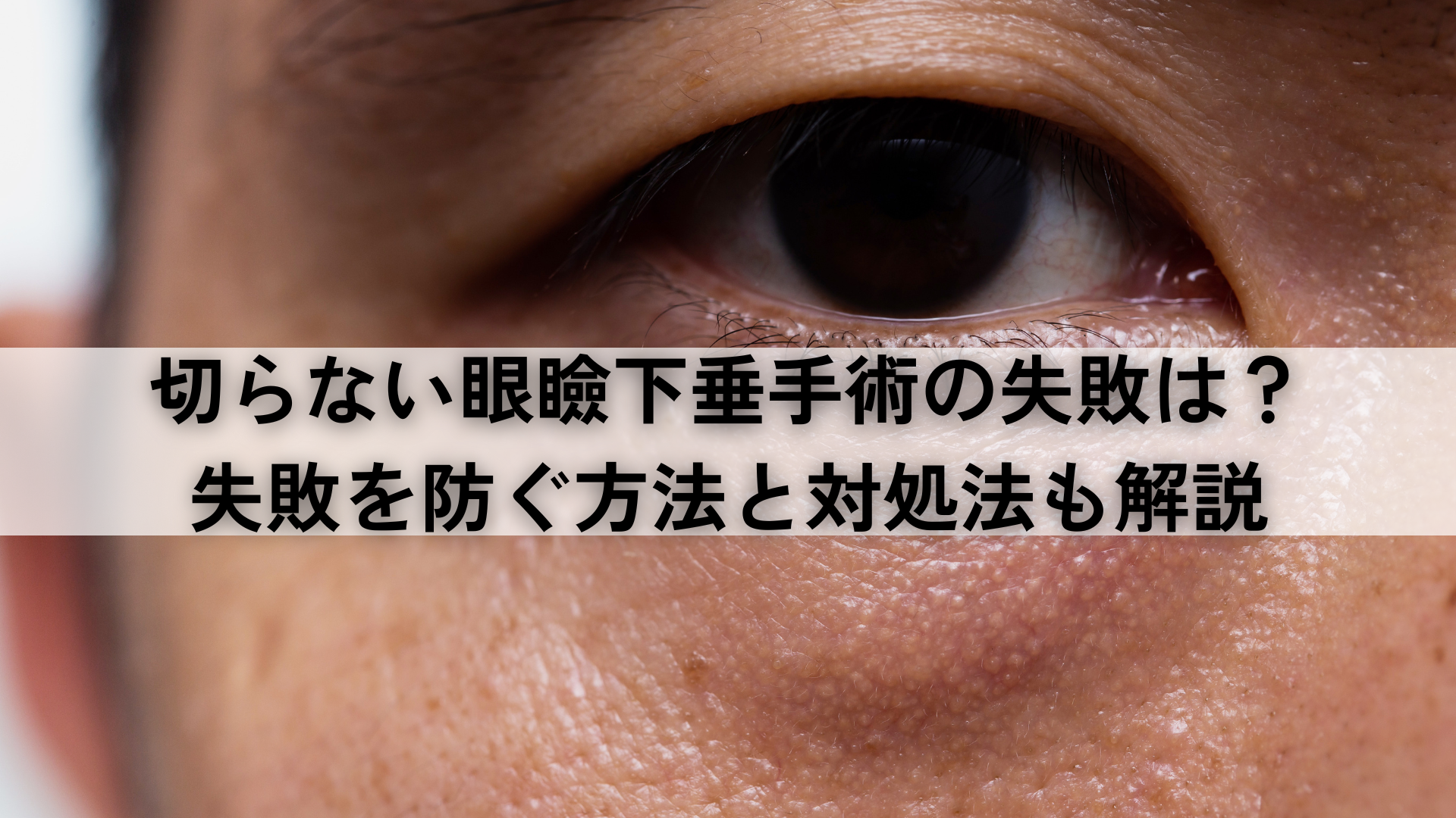 切らない眼瞼下垂手術の失敗は？失敗を防ぐ方法と対処法も解説